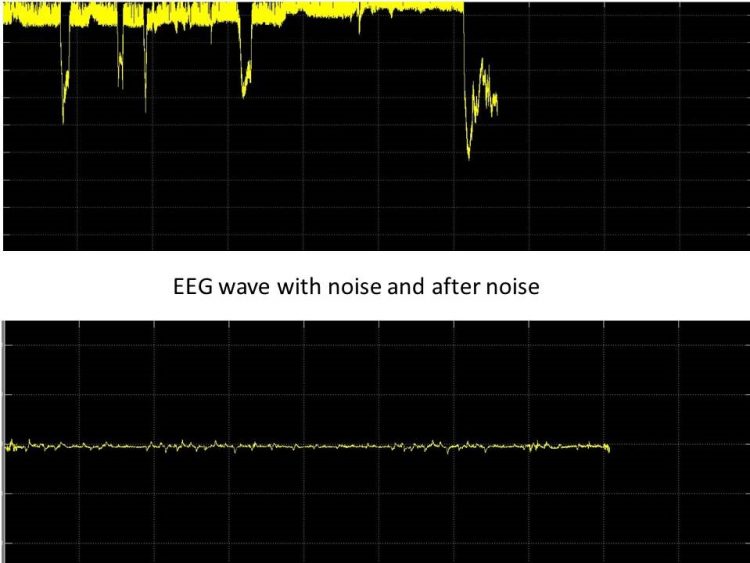 How to filter EEG waves on MATLAB Make it mech