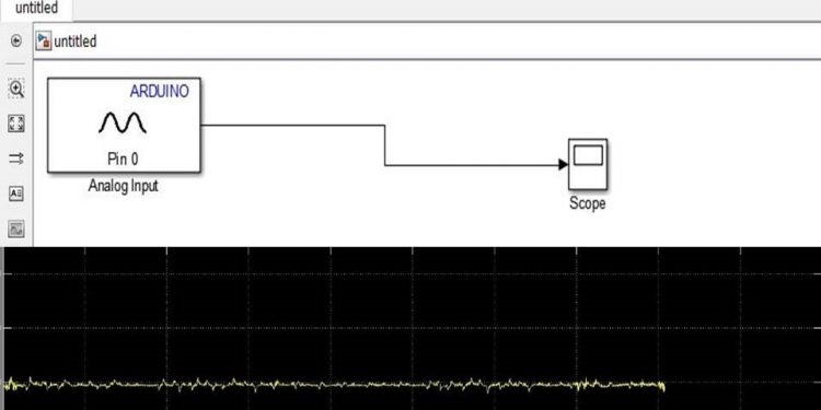 How to filter EEG waves on MATLAB 1 How to filter EEG waves on MATLAB
